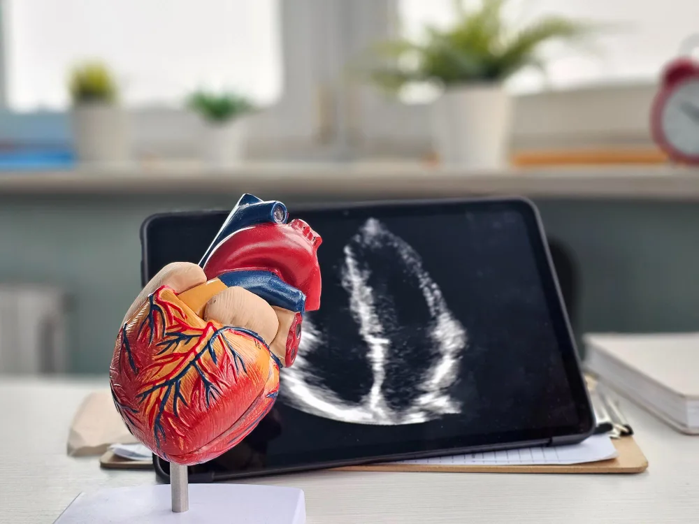 Electrocardiograma de 12 derivaciones