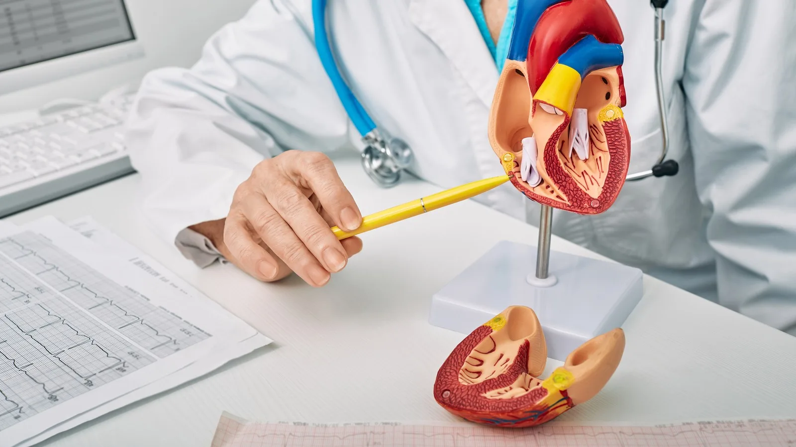 Atención especializada con un cardiólogo para diabéticos en Querétaro