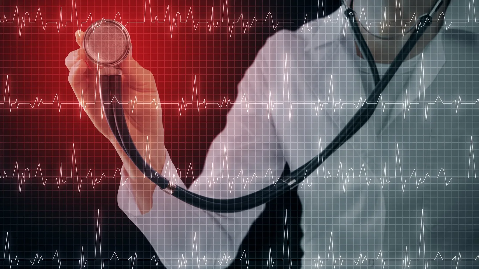 ¿Qué médico trata cardiomiopatía?