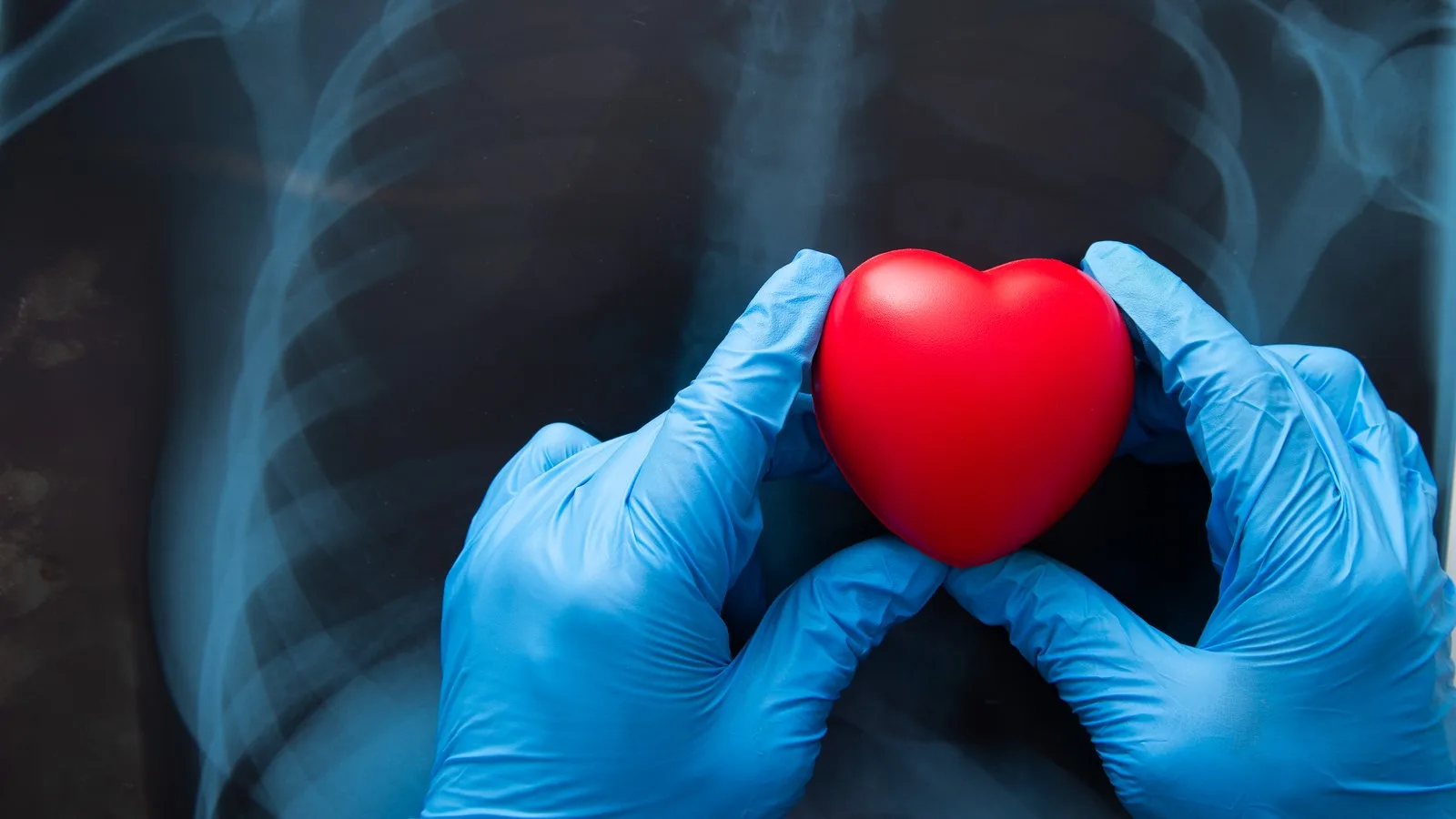Consulta para tratamiento de prevención primaria y secundaria cardiovascular en Querétaro