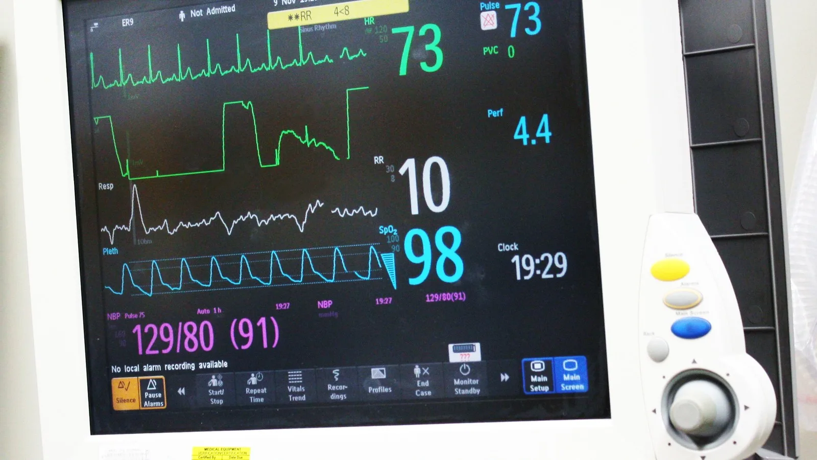 Electrocardiograma cerca de Querétaro: Evaluación del ritmo cardíaco