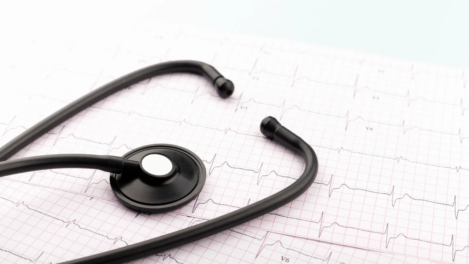 Abordaje especializado de la fibrilación auricular en Querétaro