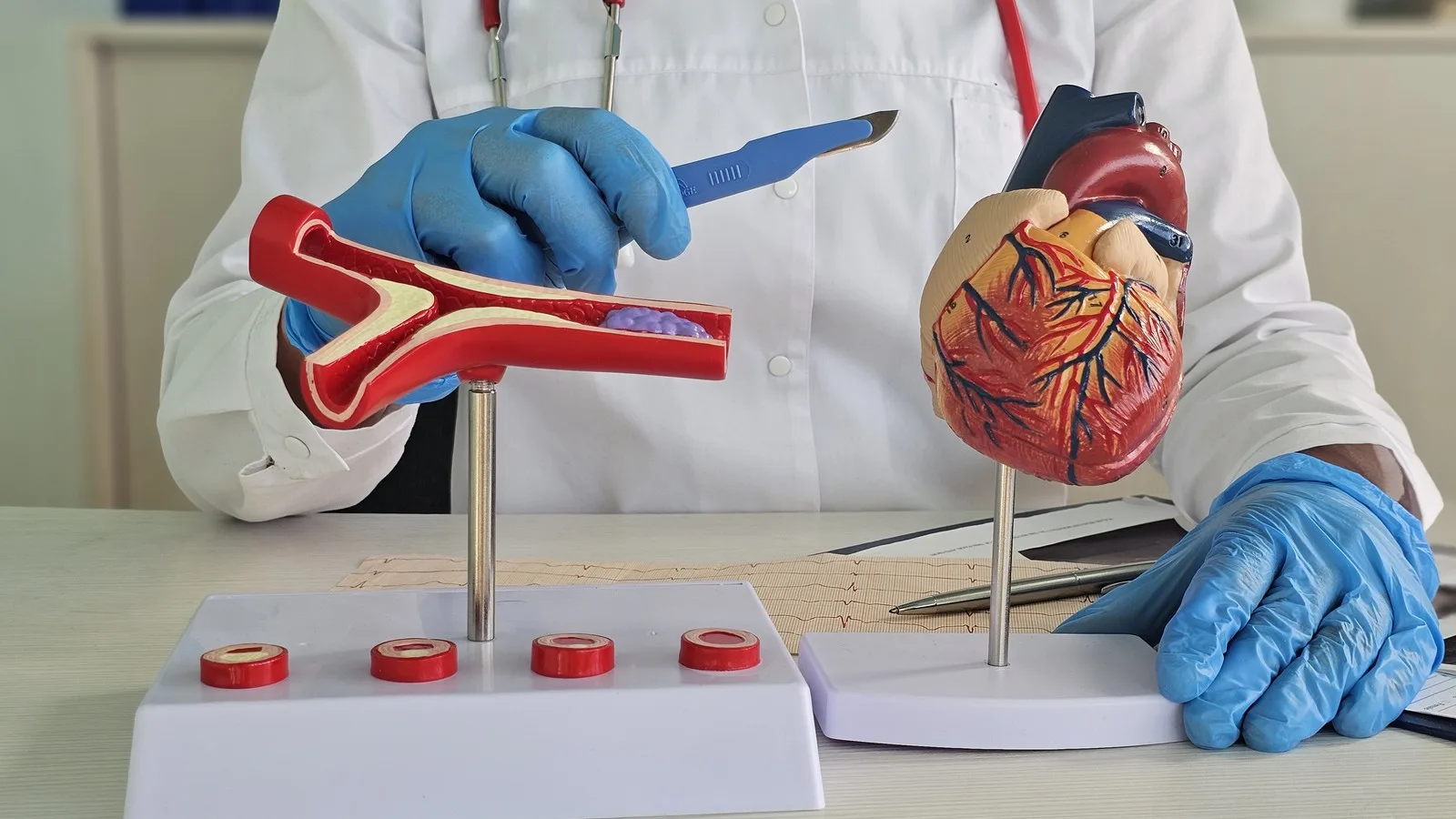 Evaluación Especializada de Soplos Cardíacos en Querétaro